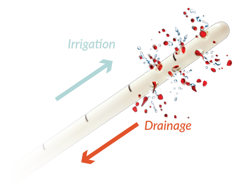 irraflow - irrigation and drainage